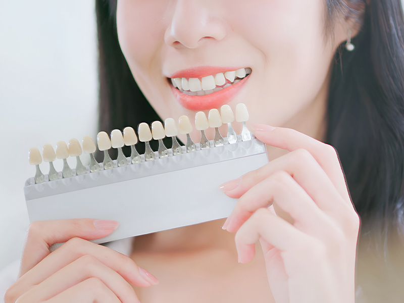 牙齒美白方式指南